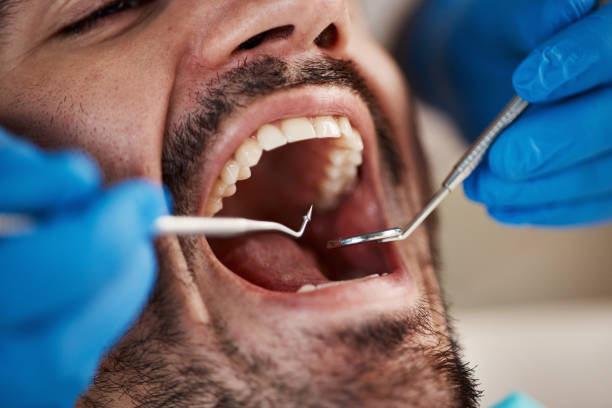 Best Cracked Tooth Emergency Dentist  in Tallahassee, FL